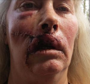 Ginger Sugerman after being shot by her husband Arnie Lerma
